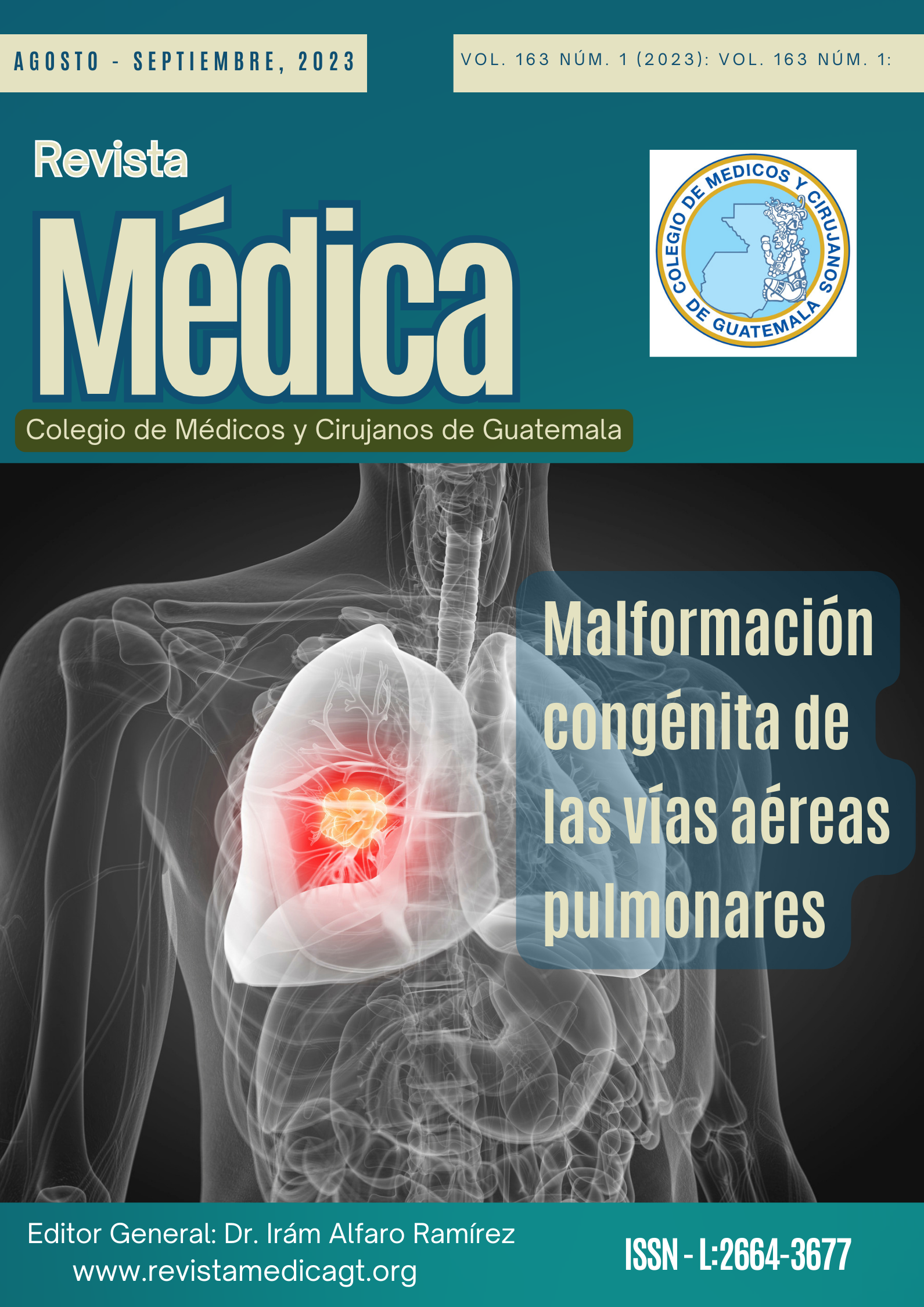 La Malformación Congénita de las Vías Aéreas Pulmonares es una rara anomalía del desarrollo del tracto respiratorio inferior.